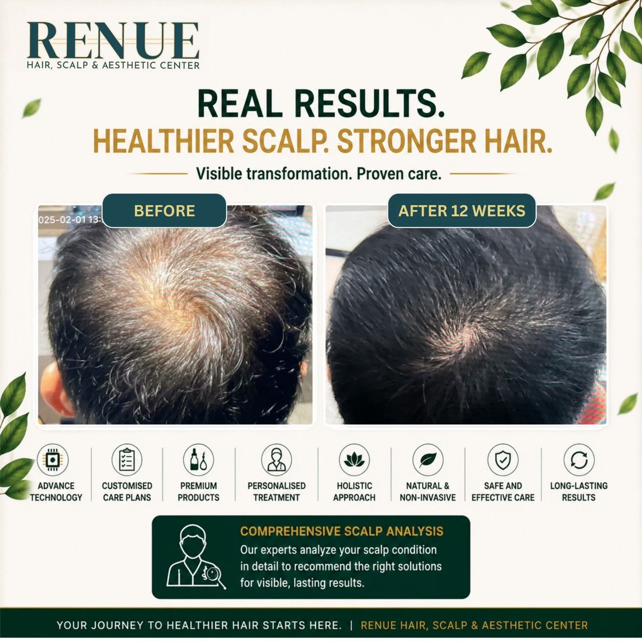 Renue Hair, Scalp & Aesthetic Center hero view